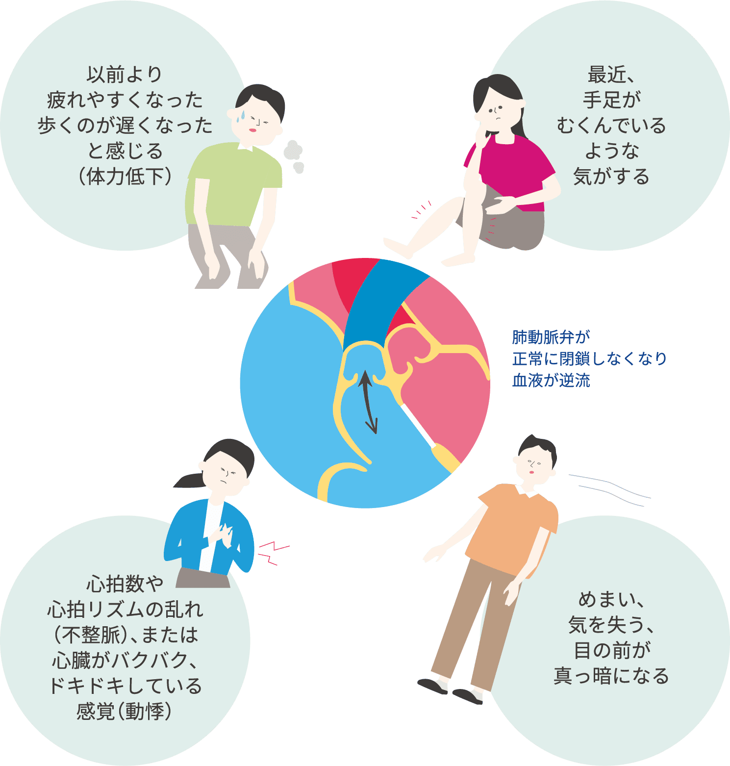 新しい弁が必要となる可能性のある症状（右心不全）
