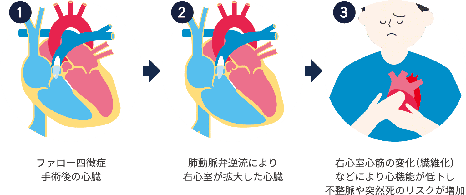 元気になった心臓、ずっと大切にするために
